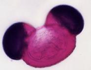 マツ花粉の顕微鏡写真1